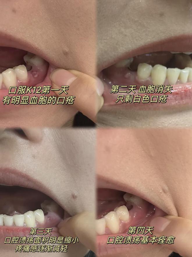 彩神vll春天长高季别让这6个“长高谣言”耽误孩子身高(图10)